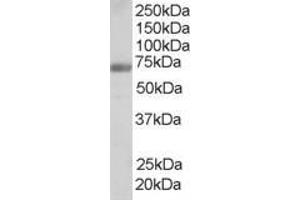 Western Blotting (WB) image for anti-Formin Binding Protein 1 (FNBP1) (Internal Region) antibody (ABIN2465683) (FNBP1 antibody  (Internal Region))