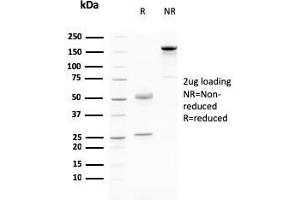 SDS-PAGE Analysis Purified Desmoglein-3 Mouse Monoclonal Antibody (DSG3/2796). (Desmoglein 3 antibody  (AA 379-491))