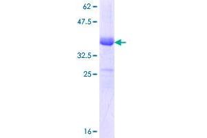 SLC12A2 Protein (AA 903-1010) (GST tag)