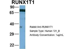Human 721_B; Host: Rabbit. (RUNX1T1 antibody  (Middle Region))