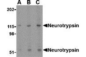 Western Blotting (WB) image for anti-Protease, serine, 12 (Neurotrypsin, Motopsin) (PRSS12) (N-Term) antibody (ABIN1031478) (Neurotrypsin antibody  (N-Term))