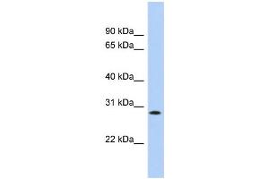 WB Suggested Anti-KCTD17 Antibody Titration:  0. (KCTD17 antibody  (Middle Region))