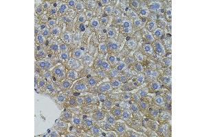 Immunohistochemistry of paraffin-embedded mouse liver using MFN2 antibody. (MFN2 antibody)