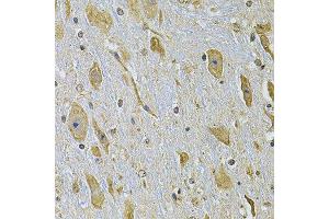 Immunohistochemistry of paraffin-embedded mouse brain using ITGA2 Antibody. (ITGA2 antibody)