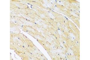 Immunohistochemistry of paraffin-embedded Mouse heart using ARL4A Polyclonal Antibody at dilution of 1:100 (40x lens).