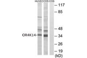 Western blot analysis of extracts from COS7/HuvEc cells, using OR4K14 Antibody. (OR4K14 antibody  (AA 261-310))