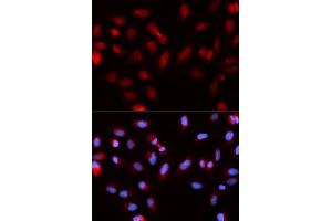Immunofluorescence analysis of U2OS cells using BIRC5 antibody. (Survivin antibody  (AA 1-142))