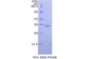 SDS-PAGE (SDS) image for Thyroid Peroxidase (TPO) (AA 636-832) protein (His tag) (ABIN1980764) (Thyroperoxidase Protein (AA 636-832) (His tag))