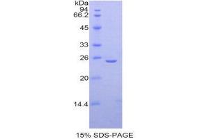 SDS-PAGE (SDS) image for Thyroid Peroxidase (TPO) (AA 636-832) protein (His tag) (ABIN1525595)