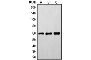 Western blot analysis of FYN (pY530) expression in HeLa (A), mouse brain (B), rat brain (C) whole cell lysates.