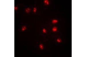 Immunofluorescent analysis of BAF57 staining in SW620 cells. (SMARCE1 antibody)