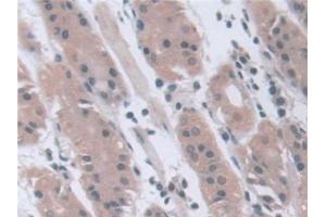 Immunohistochemistry (IHC) image for anti-Stress-Induced-phosphoprotein 1 (STIP1) (AA 1-169) antibody (ABIN7436411)