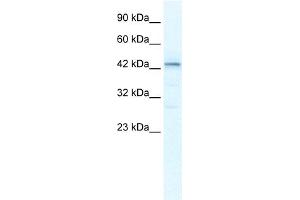 WB Suggested Anti-SP140L Antibody Titration:  2. (SP140L antibody  (Middle Region))
