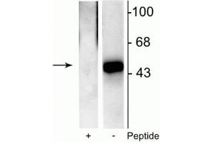 Western blot of recombinant Elk-1 showing specific immunolabeling of the ~46 kDa Elk-1 phosphorylated at Ser383 in the right lane (-). (ELK1 antibody  (pSer383))
