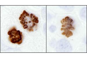 Immunohistochemistry (IHC) image for anti-Histone H3 (H3) (pSer10) antibody (ABIN7449558) (Histone 3 antibody  (pSer10))