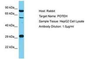 Image no. 1 for anti-POTE Ankyrin Domain Family, Member H (POTEH) (AA 421-470) antibody (ABIN6750592) (POTEH antibody  (AA 421-470))
