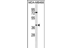 ABHD1 Antibody (C-term) (ABIN1537062 and ABIN2849972) western blot analysis in MDA-M cell line lysates (35 μg/lane). (ABHD1 antibody  (C-Term))