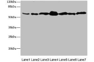 Western blot All lanes: NAE1 antibody at 1. (NAE1 antibody  (Regulatory Subunit))