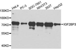 Western blot analysis of extracts of various cell lines, using IGF2BP3 antibody. (IGF2BP3 antibody  (AA 1-200))