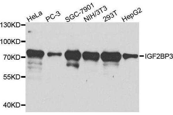 IGF2BP3 antibody  (AA 1-200)