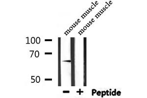 Western blot analysis of extracts from mouse muscle, using SELE Antibody. (Selectin E/CD62e antibody  (N-Term))