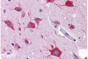 Human Brain, Cortex: Formalin-Fixed, Paraffin-Embedded (FFPE) (FAM59A antibody  (C-Term))