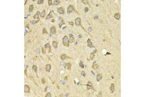 Immunohistochemistry of paraffin-embedded rat brain using IL10RA Antibody (ABIN5970931) at dilution of 1/200 (40x lens).
