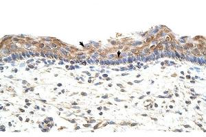 GNB1L antibody was used for immunohistochemistry at a concentration of 4-8 ug/ml to stain Squamous epithelial cells (arrows) in Human Skin. (GNB1L antibody)