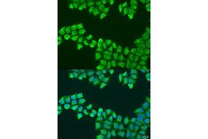 Immunofluorescence analysis of U2OS cells using F1 antibody (ABIN6131059, ABIN6137331, ABIN6137332 and ABIN6223561) at dilution of 1:100. (ATP5F1 antibody  (AA 1-245))