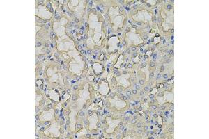 Immunohistochemistry of paraffin-embedded rat kidney using CLTC antibody (ABIN5995396) (40x lens).