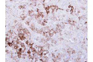 IHC-P Image Immunohistochemical analysis of paraffin-embedded DU-145 xenograft, using ALDH1A1, antibody at 1:500 dilution. (ALDH1A1 antibody  (C-Term))