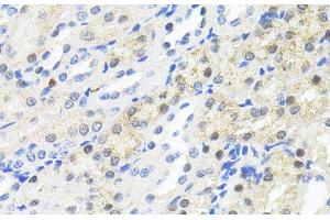 Immunohistochemistry of paraffin-embedded Mouse kidney using TRIM27 Polyclonal Antibody at dilution of 1:100 (40x lens). (TRIM27 antibody)