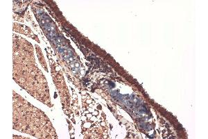 SLC5A5 antibody  (AA 468-643) (HRP)