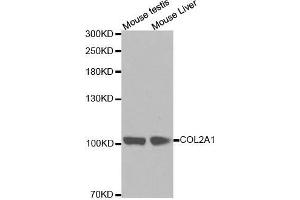 Western blot analysis of extracts of various cell lines, using COL2A1 antibody. (COL2A1 antibody  (AA 873-1072))