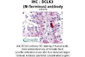 Image no. 2 for anti-Doublecortin-Like Kinase 3 (DCLK3) (N-Term) antibody (ABIN1733544) (DCLK3 antibody  (N-Term))
