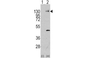 Western blot analysis of PDGFR antibody and 293 cell lysate (2 ug/lane) either nontransfected (Lane 1) or transiently transfected with the PDGFRA gene (2). (PDGFRA antibody  (AA 698-727))
