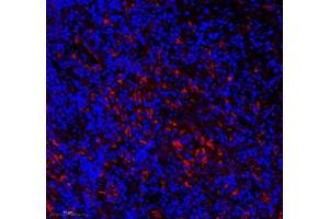 Immunofluorescence of paraffin embedded mouse thymus using CD163b (ABIN7073371) at dilution of 1: 700 (300x lens) (CD163L1 antibody)