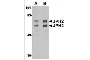 Western blot analysis of JPH2 in mouse brain tissue lysate with JPH2 antibody at (A) 1 and (B) 2 µg/ml (Junctophilin 2 antibody  (C-Term))