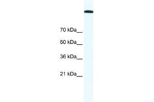 TOP2A antibody (20R-1304) used at 1. (Topoisomerase II alpha antibody  (C-Term))