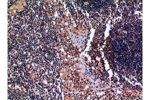 Immunohistochemistry (IHC) analysis of paraffin-embedded Human Lymph Gland, antibody was diluted at 1:100. (Cytokeratin 19 antibody  (C-Term))