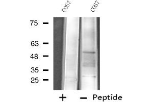 Western blot analysis of extracts from COS7 cells, using Cytochrome P450 4X1 antibody. (CYP4X1 antibody)