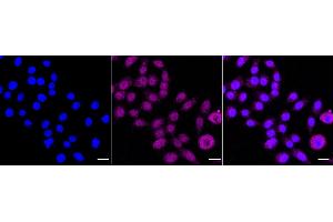 Immunocytochemical staining of HepG2 cells with NR2C2 antibody (ABIN7799652), 1:1,000).
