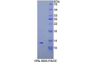 SDS-PAGE analysis of Cow IP10 Protein. (CXCL10 Protein)