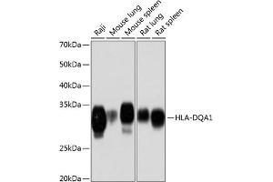 Western blot analysis of extracts of various cell lines, using HLA-DQ Rabbit mAb (1252) at 1:1000 dilution. (HLA-DQA1 antibody)