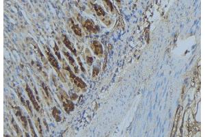 ABIN6277333 at 1/100 staining Human gastric tissue by IHC-P. (IMMT antibody  (Internal Region))