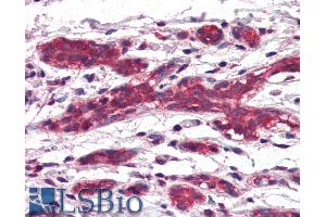 ABIN335130 (5µg/ml) staining of paraffin embedded Human Breast.