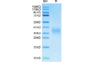 Mouse PGF on Tris-Bis PAGE under reduced condition. (PLGF Protein (AA 19-158) (His tag))