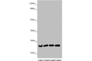 Western blot All lanes: B9D1 antibody at 6. (B9D1 antibody  (AA 1-130))