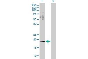 Western Blot analysis of HYI expression in transfected 293T cell line by HYI MaxPab polyclonal antibody. (HYI antibody  (AA 1-174))