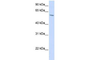 WB Suggested Anti-PORCN Antibody Titration:  0. (PORCN antibody  (N-Term))